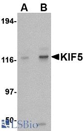 Western blot of KIF5 in K562 cell lysate with KIF5 antibody at (A) 0.5 and (B) 1 ug/ml.
