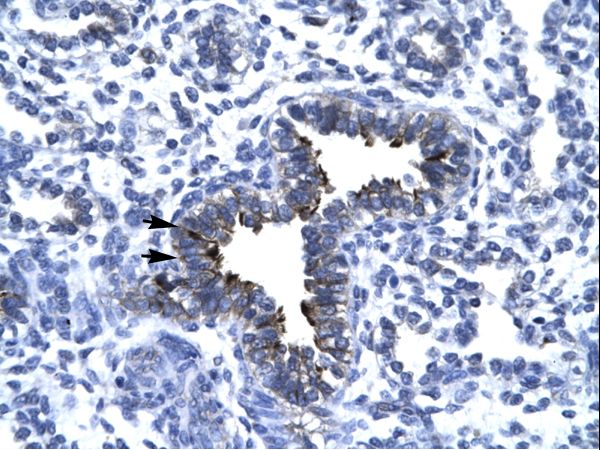 KIF5A antibody LS-C30431 was used in IHC to stain formalin-fixed, paraffin-embedded human lung.