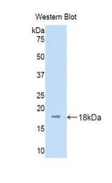 Western blot of recombinant Kinesin 5A / KIF5A.