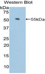 Western blot of recombinant Kinesin 5A / KIF5A.