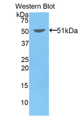 Western blot of recombinant Kinesin 5A / KIF5A.