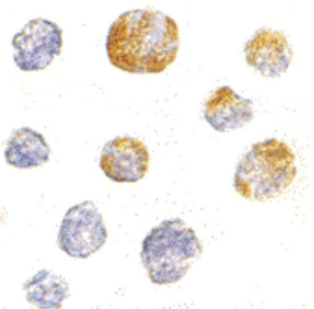 Immunocytochemistry of KIF5 in K562 cells with KIF5 antibody at 5 ug/ml.