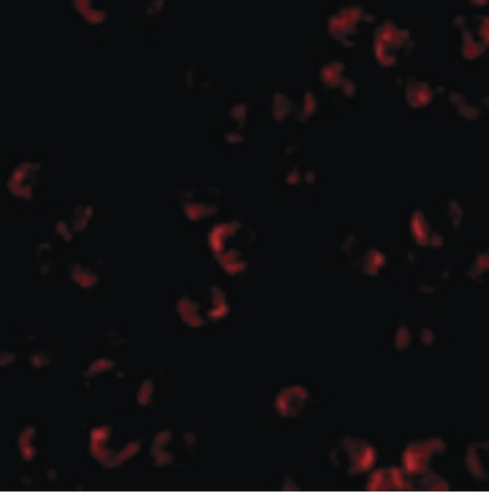 Immunofluorescence of KIF5 in K562 cells with KIF5 antibody at 20 ug/ml.