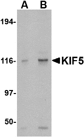 Western blot of KIF5 in K562 cell lysate with KIF5 antibody at (A) 0.5 and (B) 1 ug/ml.