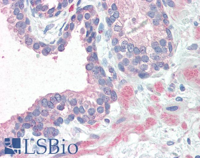 Anti-KIF5B antibody IHC of human prostate. Immunohistochemistry of formalin-fixed, paraffin-embedded tissue after heat-induced antigen retrieval. Antibody LS-B3302 concentration 10 ug/ml.