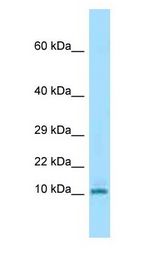 KRTAP3-3 antibody Western Blot of Mouse Spleen.