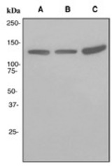 Western blot analysis on (A) SH-SY5Y, (B) MCF-7 and (C) A673 cell lysates using anti-KCNH1 antibody.