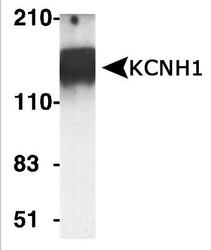 KCNH1 Antibody - Western blot of KCNH1 expression in rat brain lysate.
