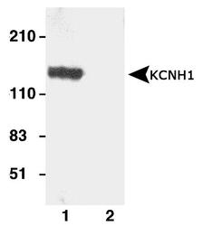 KCNH1 Antibody - Western blot of KCNH1 expression in HEK cells transfected with rat KCNH1. Lane 1: anti-KCNH1 antibody. Lane2: anti-KCNH1 antibody preincubated with the antigen peptide.