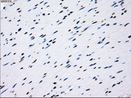 IHC of paraffin-embedded colon tissue using anti-L1CAM mouse monoclonal antibody. (Dilution 1:50).