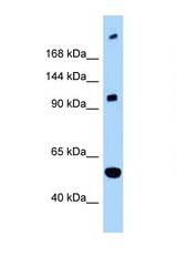L1CAM antibody LS-C146069 Western blot of Fetal Brain lysate. Antibody concentration 1 ug/ml.