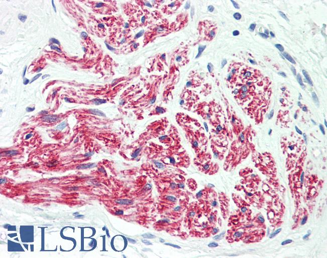 Anti-L1CAM antibody IHC staining of human peripheral nerve. Immunohistochemistry of formalin-fixed, paraffin-embedded tissue after heat-induced antigen retrieval. Antibody LS-B9803 dilution 1:100.