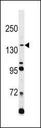 L1CAM Antibody western blot of Jurkat cell line lysates (35 ug/lane). The L1CAM antibody detected the L1CAM protein (arrow).