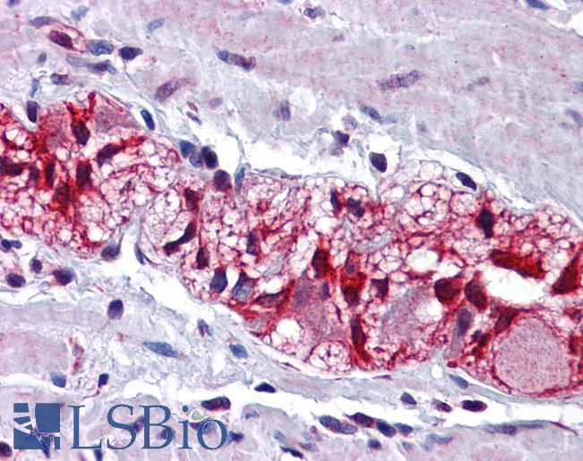 Anti-GRIN2B / NMDAR2B antibody IHC of human colon, myenteric plexus. Immunohistochemistry of formalin-fixed, paraffin-embedded tissue after heat-induced antigen retrieval. Antibody LS-B5614 concentration 5 ug/ml.
