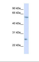 HepG2 cell lysate. Antibody concentration: 1.0 ug/ml. Gel concentration: 12%.