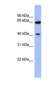 LASS2 antibody LS-C110400 Western blot of Fetal Kidney lysate.