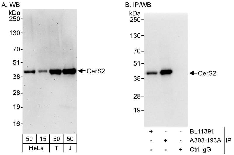 Detection of Human CerS2 by Western Blot and Immunoprecipitation. Samples: Whole cell lysate from HeLa (15 and 50 ug for WB; 1 mg for IP, 20% of IP loaded), 293T (T; 50 ug) and Jurkat (J; 50 ug) cells. Antibodies: Affinity purified rabbit anti-CerS2 antibody used for WB at 0.04 ug/ml (A) and 1 ug/ml (B) and used for IP at 6 ug/mg lysate. CerS2 was also immunoprecipitated by rabbit anti-CerS2 antibody BL11391, which recognizes an upstream epitope. Detection: Chemiluminescence with exposure times of 3 minutes (A) and 3 seconds (B).