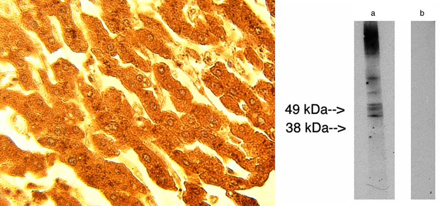 Left: IHC of normal human liver tissue using Lass2 antibody (LS-C140582) at 15 ug/ml. Right: Western blot of LAG1 longevity assurance homolog 2 (LS-C140582) at 10 ug/ml on human placenta lysate 14 ug/lane. Lane A] antibody alone, Lane B] conjugate alone. Visualized using Pierce West Femto substrate system. Anti Rabbit secondary used at 1:10K dilution. Exposure for 5 minutes