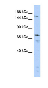 GRIN2B / NMDAR2B antibody LS-B5614 Western blot of Fetal Brain lysate.