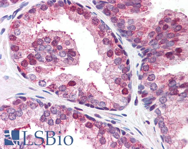 Anti-GOLPH3 antibody IHC of human prostate. Immunohistochemistry of formalin-fixed, paraffin-embedded tissue after heat-induced antigen retrieval. Antibody LS-B5044 concentration 5 ug/ml.