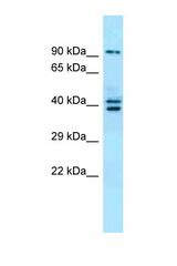 L3MBTL3 antibody LS-C116399 Western blot of Placenta lysate. Antibody concentration 1 ug/ml.