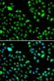Immunofluorescence blot of MCF7 cell using L3MBTL3 antibody. Blue: DAPI for nuclear staining.