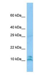LALBA / Alpha Lactalbumin antibody Western Blot of THP-1 cell lysate.