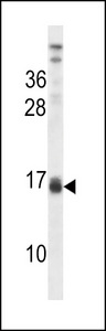 LALBA Antibody western blot of CEM cell line lysates (35 ug/lane). The LALBA antibody detected the LALBA protein (arrow).