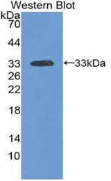 Western blot of recombinant LAMA3 / Laminin Alpha 3.