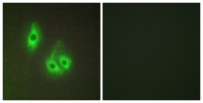 Immunofluorescence of HepG2 cells, using LAMA3 Antibody. The picture on the right is treated with the synthesized peptide.