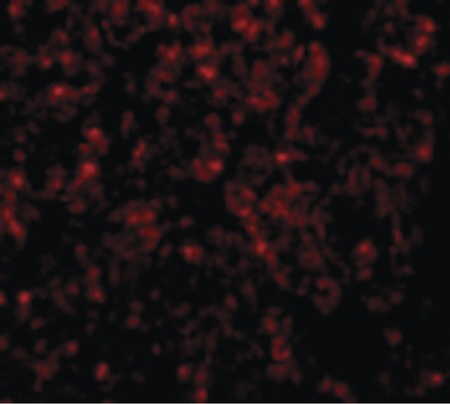 Immunofluorescence of GOLPH3 in Rat Lung cells with GOLPH3 antibody at 20 ug/ml.