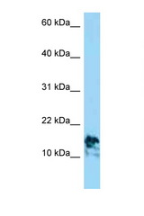 LAMA4 antibody LS-C146216 Western blot of Jurkat Cell lysate. Antibody concentration 1 ug/ml.