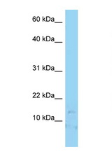 LAMA4 antibody LS-C146217 Western blot of Jurkat Cell lysate. Antibody concentration 1 ug/ml.