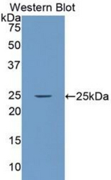 Western blot of recombinant LAMA4 / Laminin Alpha 4.