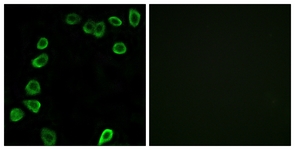 Immunofluorescence of NIH-3T3 cells, using LAMA4 Antibody. The picture on the right is treated with the synthesized peptide.