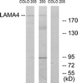 Western blot of extracts from COLO/293 cells, using LAMA4 Antibody. The lane on the right is treated with the synthesized peptide.