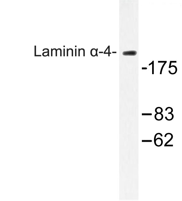 Western blot of Laminin -4 (A511) pAb in extracts from COLO cells.