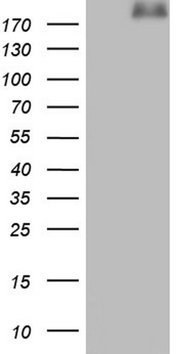 HEK293T cells were transfected with the pCMV6-ENTRY control (Left lane) or pCMV6-ENTRY LAMA4 (Right lane) cDNA for 48 hrs and lysed. Equivalent amounts of cell lysates (5 ug per lane) were separated by SDS-PAGE and immunoblotted with anti-LAMA4.