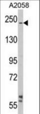 Western blot of LAMB2 Antibody in A2058 cell line lysates (35 ug/lane). LAMB2 (arrow) was detected using the purified antibody.