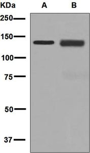 Western blot analysis on (A) HACAT and (B) A431 cell lysates using anti-LAMB3 antibody.