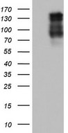 HEK293T cells were transfected with the pCMV6-ENTRY control (Left lane) or pCMV6-ENTRY LAMB3 (Right lane) cDNA for 48 hrs and lysed. Equivalent amounts of cell lysates (5 ug per lane) were separated by SDS-PAGE and immunoblotted with anti-LAMB3.