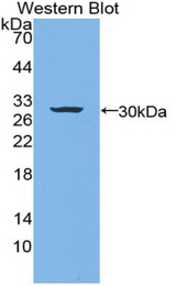 Western blot of recombinant LAMB3 / Laminin Beta 3.