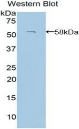 Western blot of recombinant LAMB3 / Laminin Beta 3.