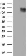 HEK293T cells were transfected with the pCMV6-ENTRY control (Left lane) or pCMV6-ENTRY LAMB3 (Right lane) cDNA for 48 hrs and lysed. Equivalent amounts of cell lysates (5 ug per lane) were separated by SDS-PAGE and immunoblotted with anti-LAMB3.