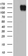 HEK293T cells were transfected with the pCMV6-ENTRY control (Left lane) or pCMV6-ENTRY LAMB3 (Right lane) cDNA for 48 hrs and lysed. Equivalent amounts of cell lysates (5 ug per lane) were separated by SDS-PAGE and immunoblotted with anti-LAMB3.