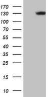 HEK293T cells were transfected with the pCMV6-ENTRY control (Left lane) or pCMV6-ENTRY LAMB3 (Right lane) cDNA for 48 hrs and lysed. Equivalent amounts of cell lysates (5 ug per lane) were separated by SDS-PAGE and immunoblotted with anti-LAMB3.