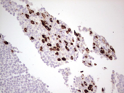 IHC of paraffin-embedded Human tonsil using anti-LAMB3 mouse monoclonal antibody. (Heat-induced epitope retrieval by 1 mM EDTA in 10mM Tris, pH8.5, 120°C for 3min).