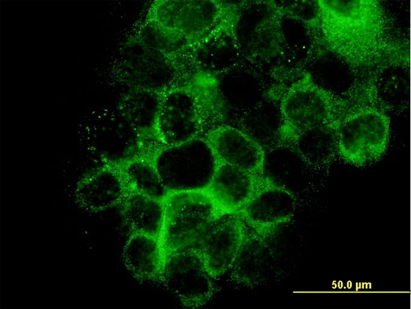 Immunofluorescence of monoclonal antibody to LAMB3 on A-431 cell. [antibody concentration 10 ug/ml]