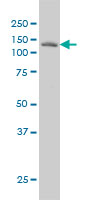 LAMB3 monoclonal antibody (M01), clone 2G10 Western Blot analysis of LAMB3 expression in A-431.
