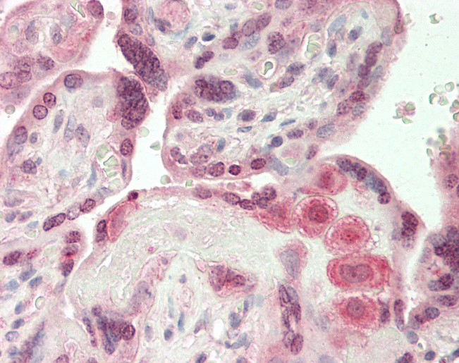 Human Placenta: Formalin-Fixed, Paraffin-Embedded (FFPE)